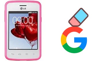 So löschen Sie ein Google-Konto auf LG L30