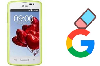 So löschen Sie ein Google-Konto auf LG L50