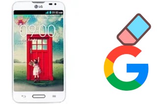 So löschen Sie ein Google-Konto auf LG L70 D320N