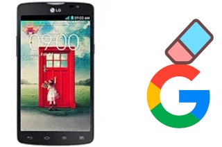 So löschen Sie ein Google-Konto auf LG L80 Dual